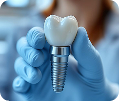 Trồng răng Implant